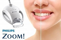 Клиническое отбеливание зубов с ZOOM 4